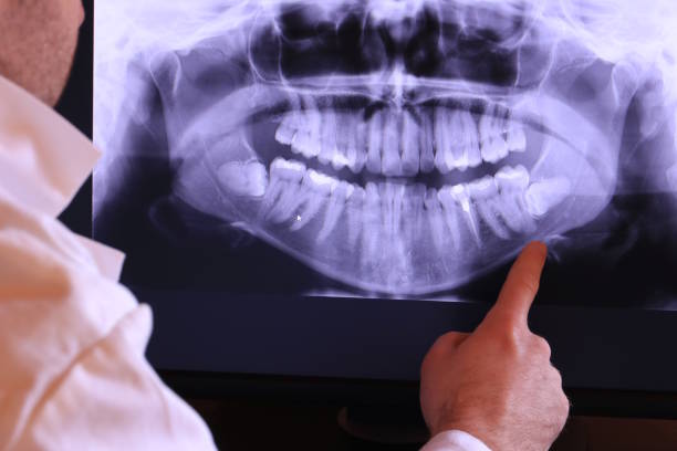 Best Chipped Tooth Repair Near Me  in Morgan Hill, CA