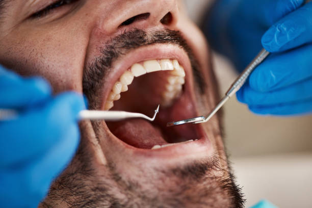 Best Tooth Pain Emergency Relief  in Morgan Hill, CA